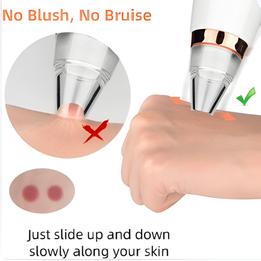 aspirateur-anti-points