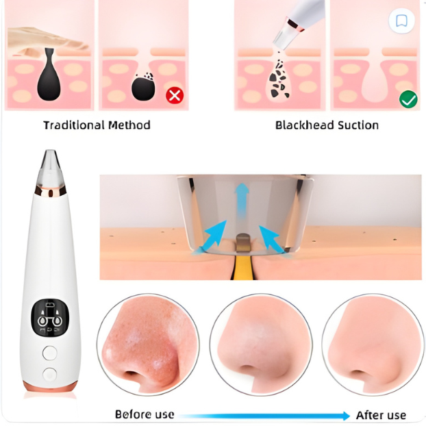 aspirateur-anti-points