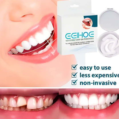 adjustable-snap-on-prostheses