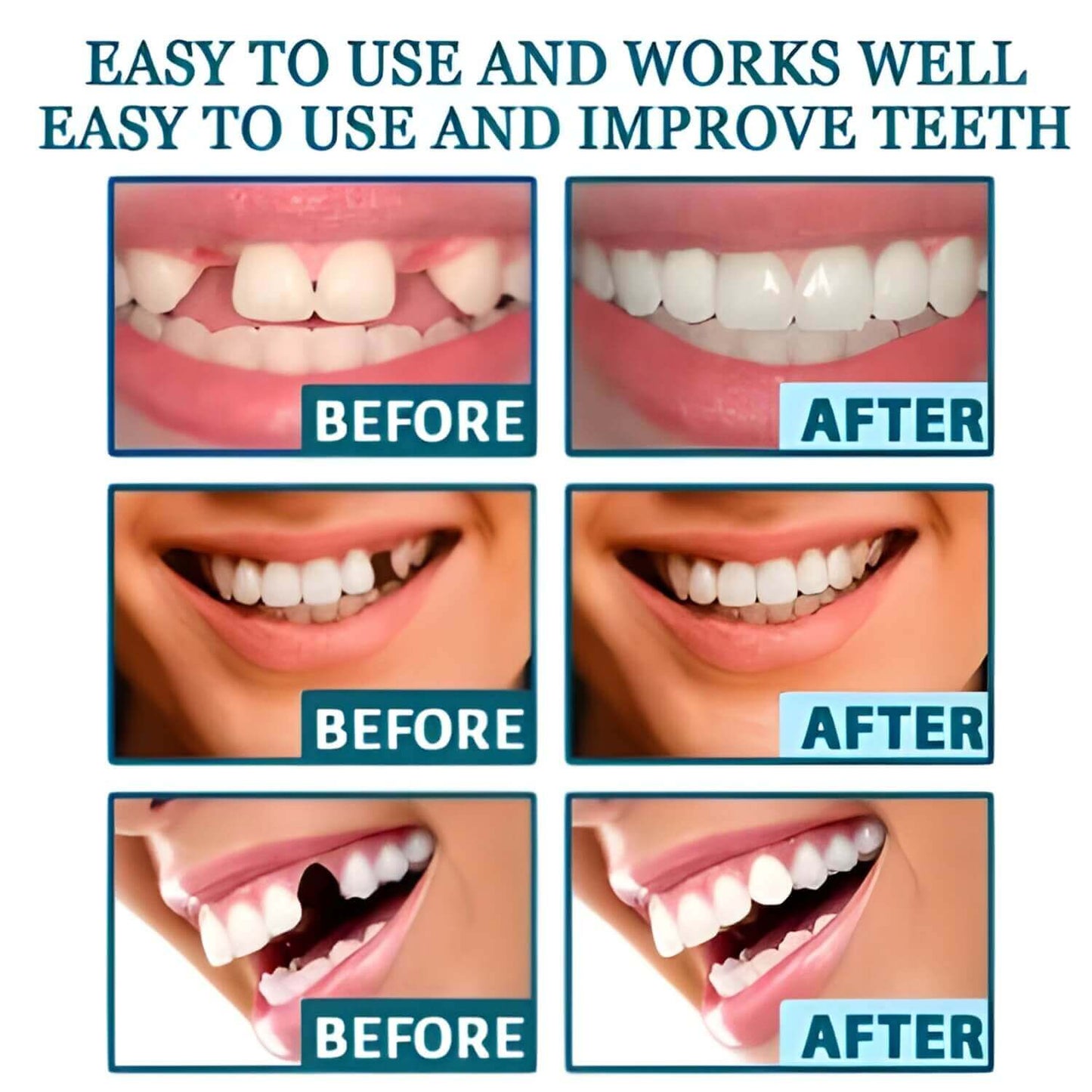 adjustable-snap-on-prostheses