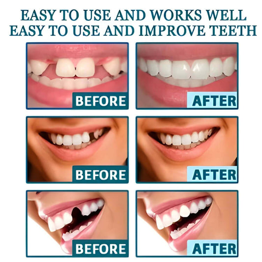 adjustable-snap-on-prostheses